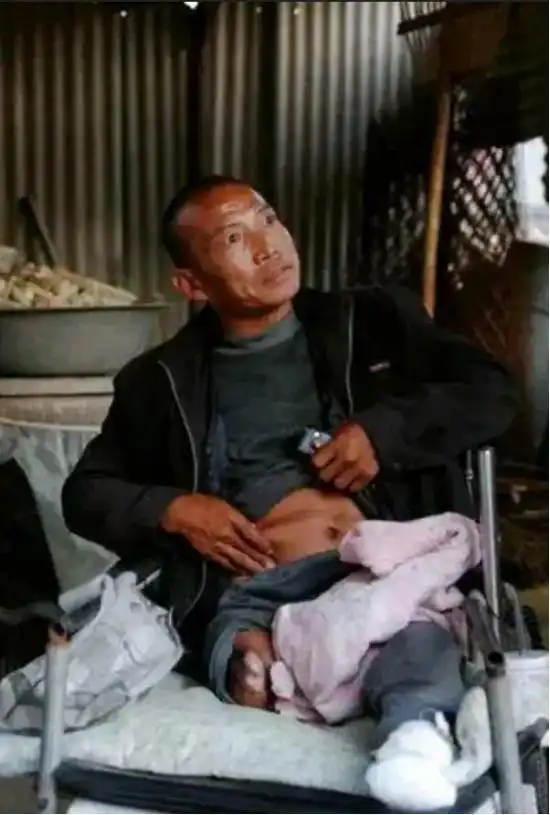 河北男子拿不出100万手术费,回家自己锯掉双腿,12年过去怎样了