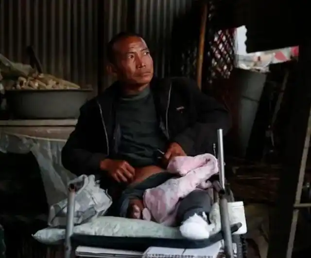 河北男子拿不出100万手术费,回家自己锯掉右腿,12年过去怎样了