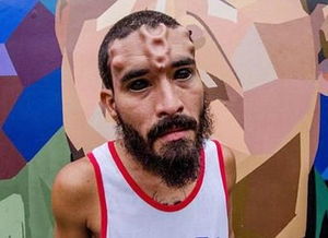 男子整容13次整成超人_委内瑞拉男子整成红骷髅_Henry Damon割鼻变红骷髅