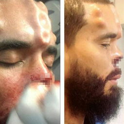 Henry Damon割鼻变红骷髅_委内瑞拉男子整成红骷髅_男子整容13次整成超人